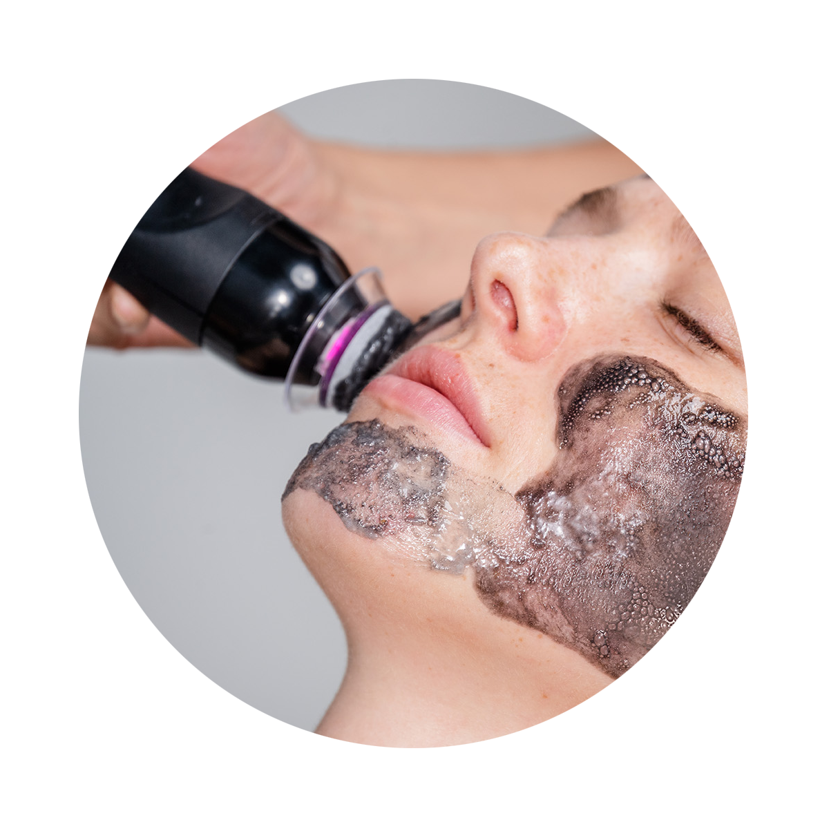 Oxfoliation™  